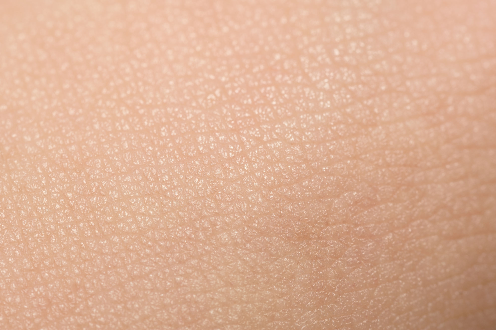 Extreme Close-Up Of Tanned Skin On Male Hand Hautarzt Hautarztpraxis Dr. Schindler Facharzt Geschlechtserkrankungen Allergologie Phlebologie Venerologie Arnsberg Team